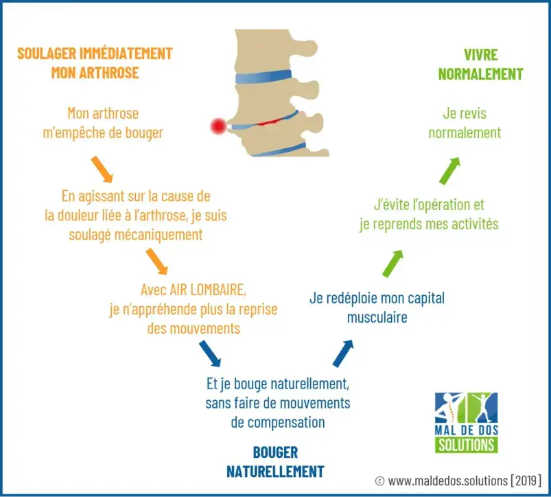 Mal de dos arthrodèse