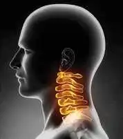 Mal de dos arthrose