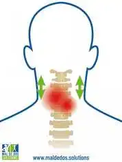 Traiter l'arthrose cervicale