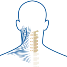Compression nerveuse due à une discopathie cervicale
