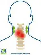 Rachis cervical et cervicalgie