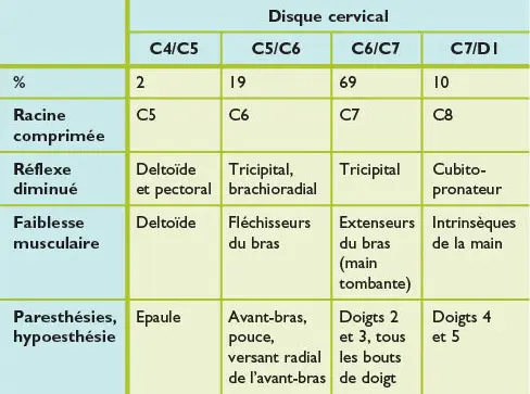 Traiter l'hernie cervicale