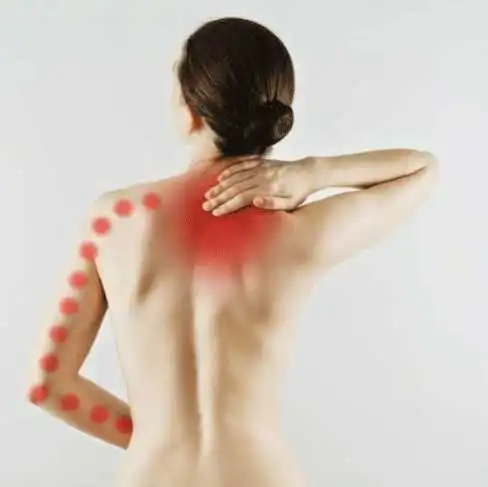 Hernie discale cervicale
