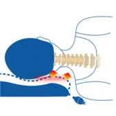 Effet d’hydratation des disques cervicaux